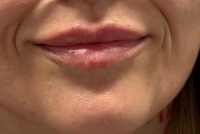 Close-up of a woman's lips and lower face with natural makeup and soft lighting