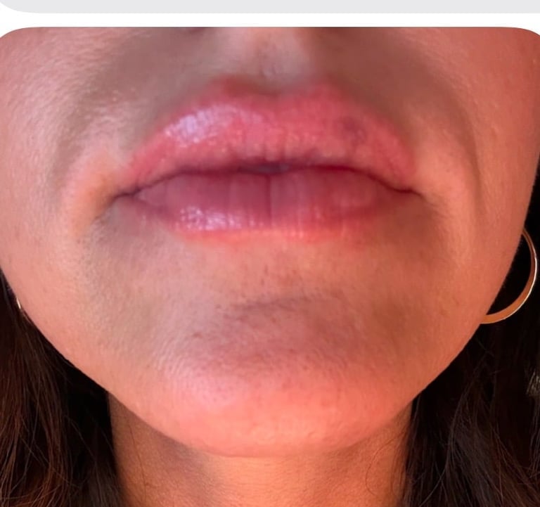 Close-up of a persons lips showing pink and peachy tones with natural texture and definition.
